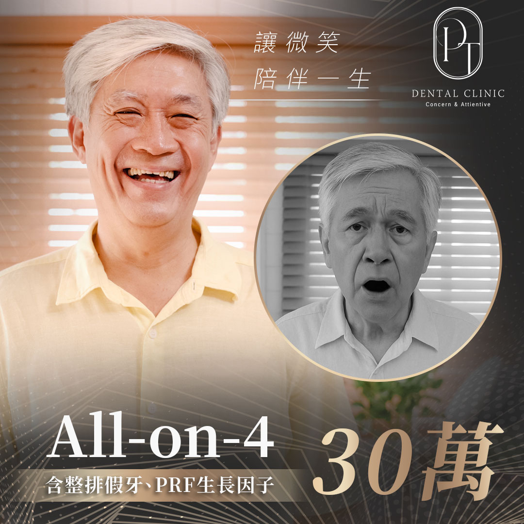 法鉑牙醫診所 Facebook ad: All on 4=植4顆+整排假牙=30萬