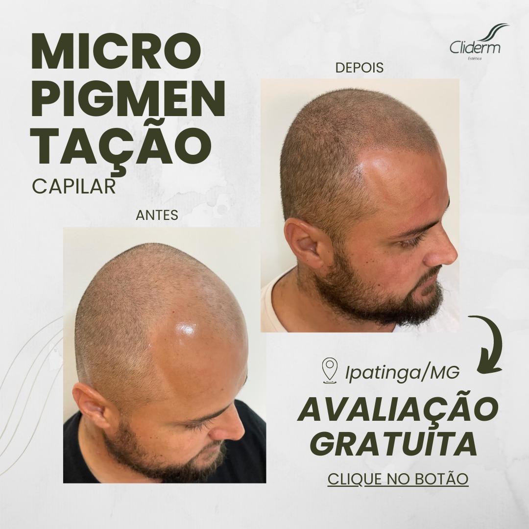 Cliderm Clínica Estética Facebook ad