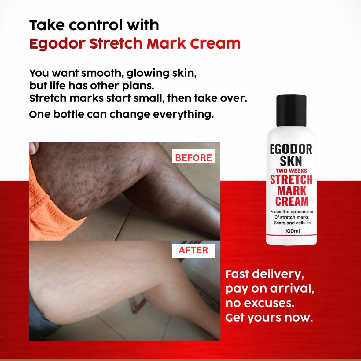 Egoodor skin Facebook ad: 2 WEEKS STRETCH MARK CREAM