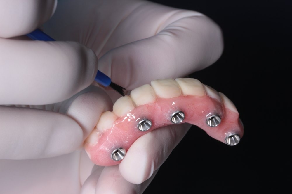 Dentist Near Me Riverside Facebook ad