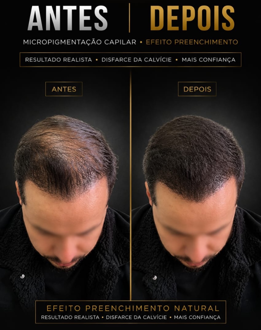 Augusto Cazella - Dermopigmentador Facebook ad: � Resultado natural, discreto e estratégico.