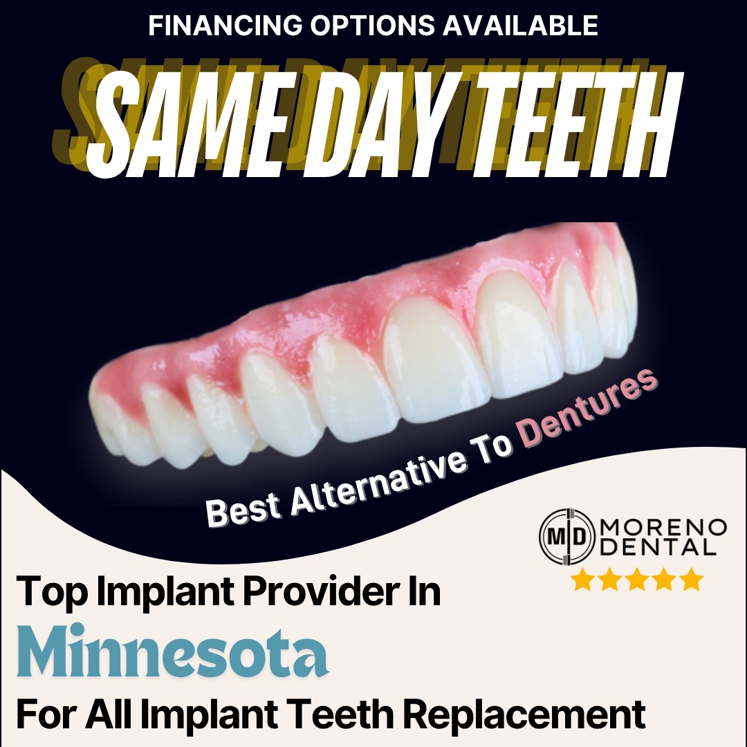 Moreno Dental Services Facebook ad