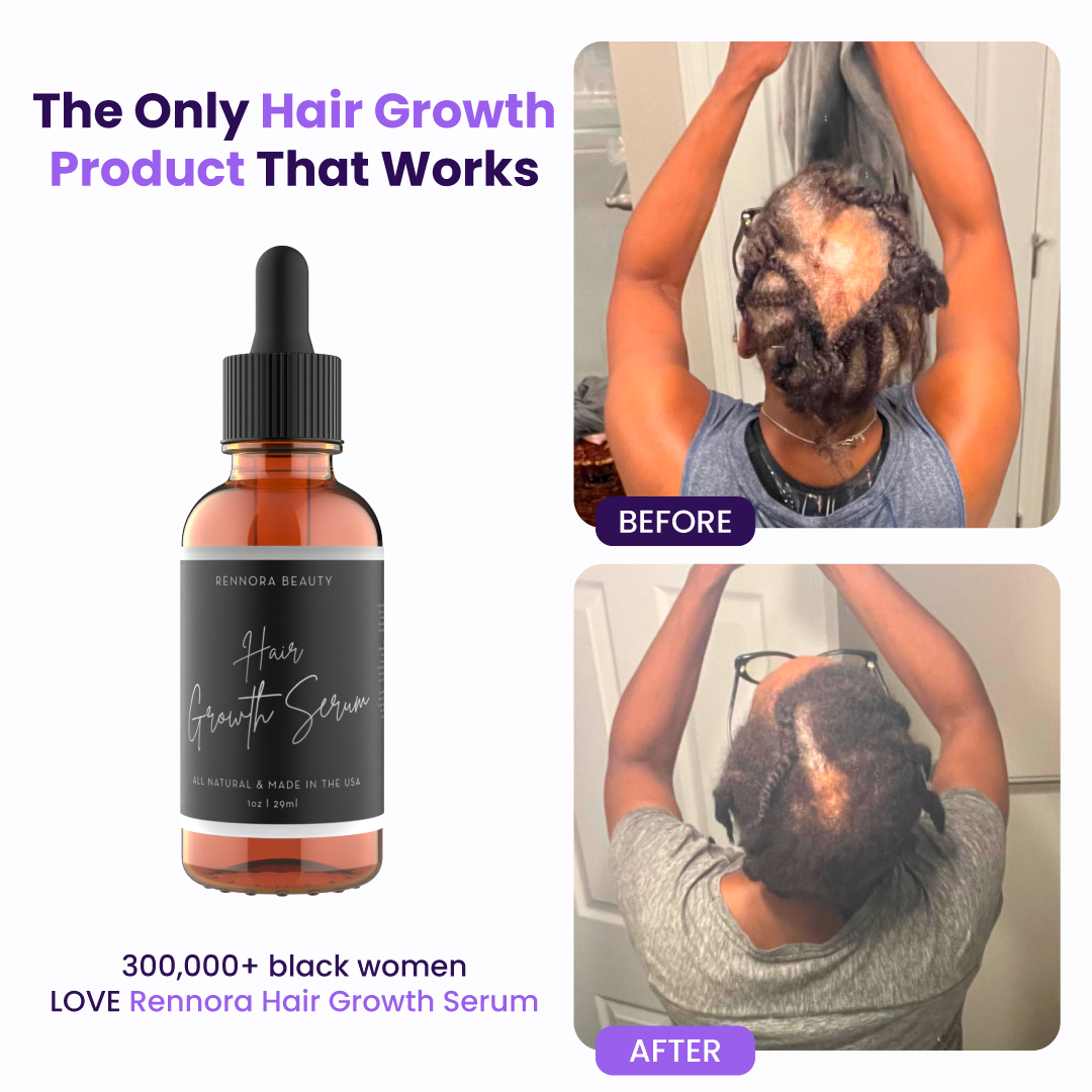 Rennora Beauty Facebook ad
