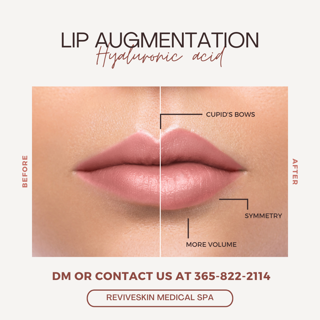 ReviveSkin Medical Spa Facebook ad from Feb 20, 2025