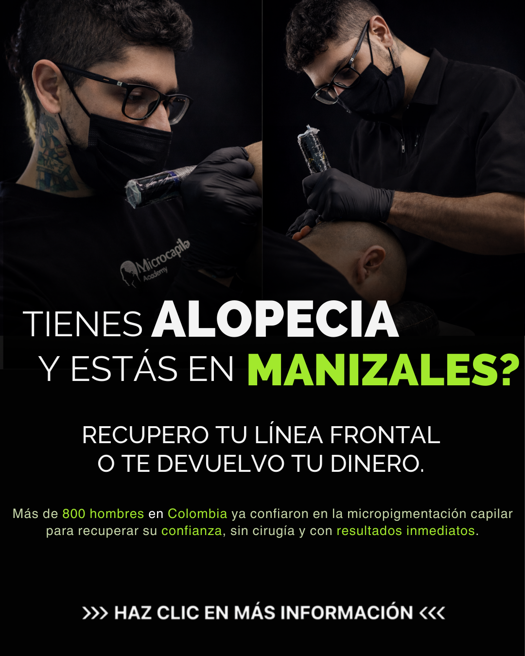 Micropigmentación capilar Facebook ad: Recupera tu Linea Frontal