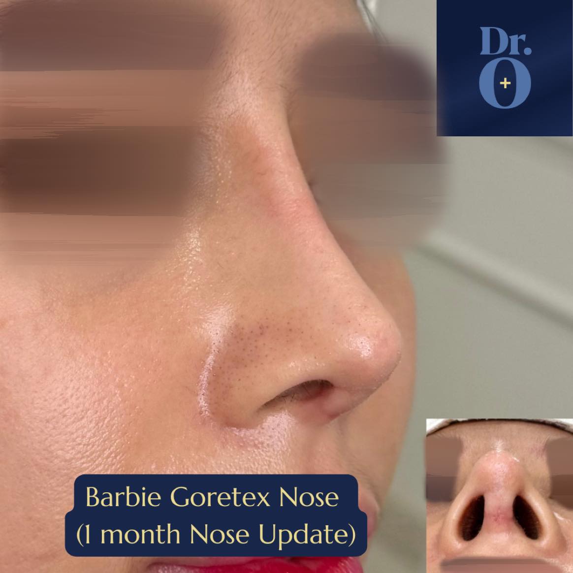 Dr. O Medical Aesthetics Facebook ad