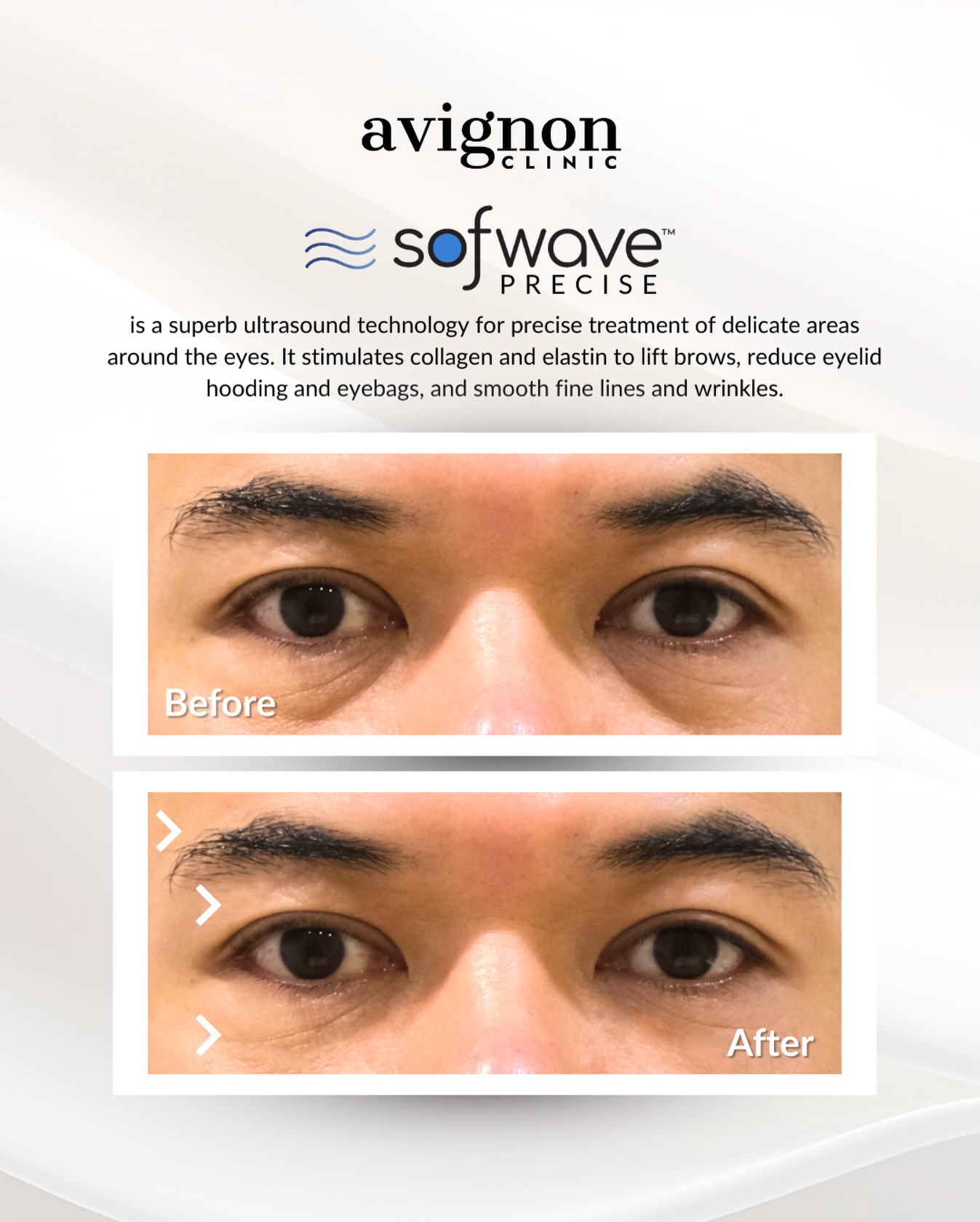 Avignon Clinic Facebook ad