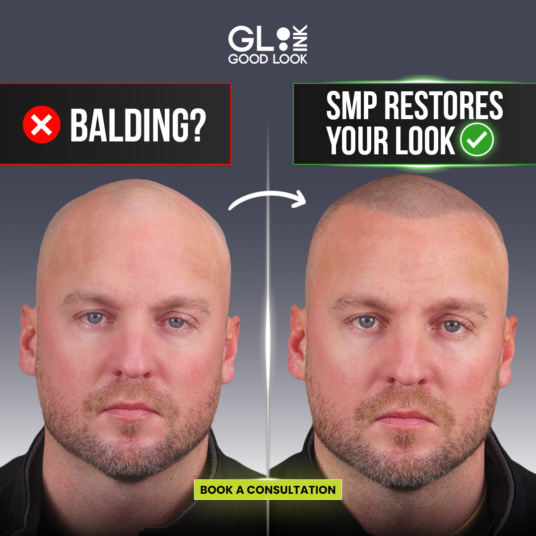 Good Look Ink Facebook ad: Minnesota, Fight Back Against Hair Loss
