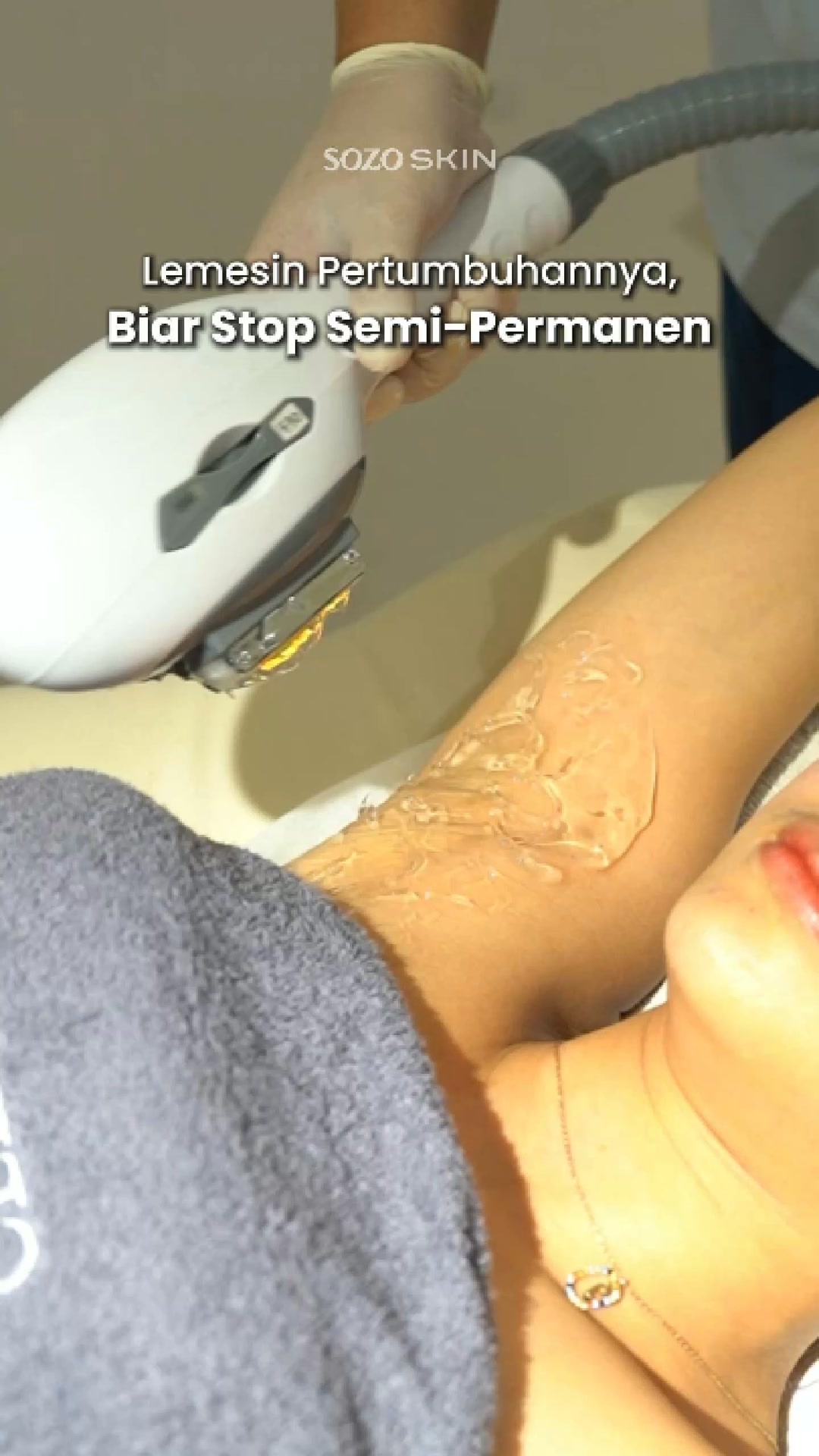 Sozo Skin Clinic Facebook ad: Promo Hair Removal Underarm 3x 349rb