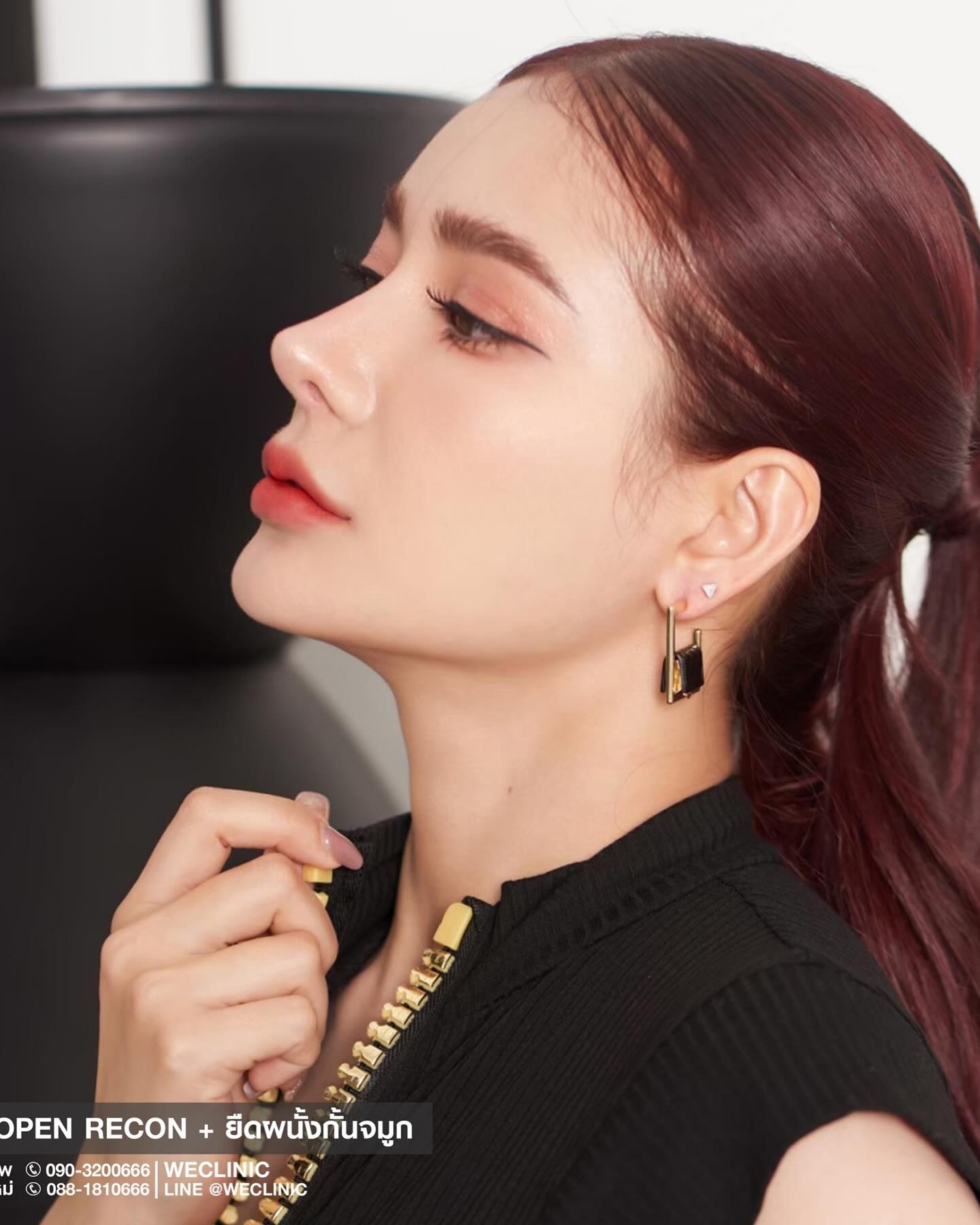 WE clinic by หมอแซม หมอดา เสริมจมูก คาง ปากกระจับ Facebook ad: 𝐖𝐡𝐞𝐫𝐞 𝐄𝐚𝐬𝐭 𝐦𝐞𝐞𝐭𝐬 𝐖𝐞𝐬𝐭: 𝐓𝐡𝐞…