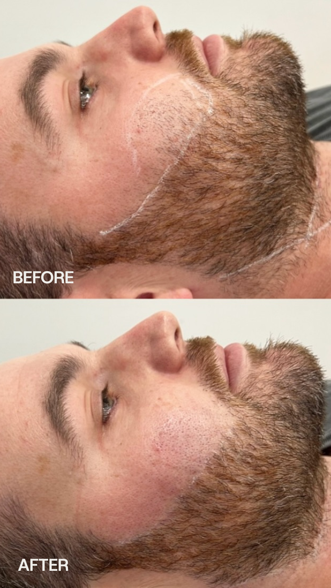 SILK Laser Clinics Facebook ad