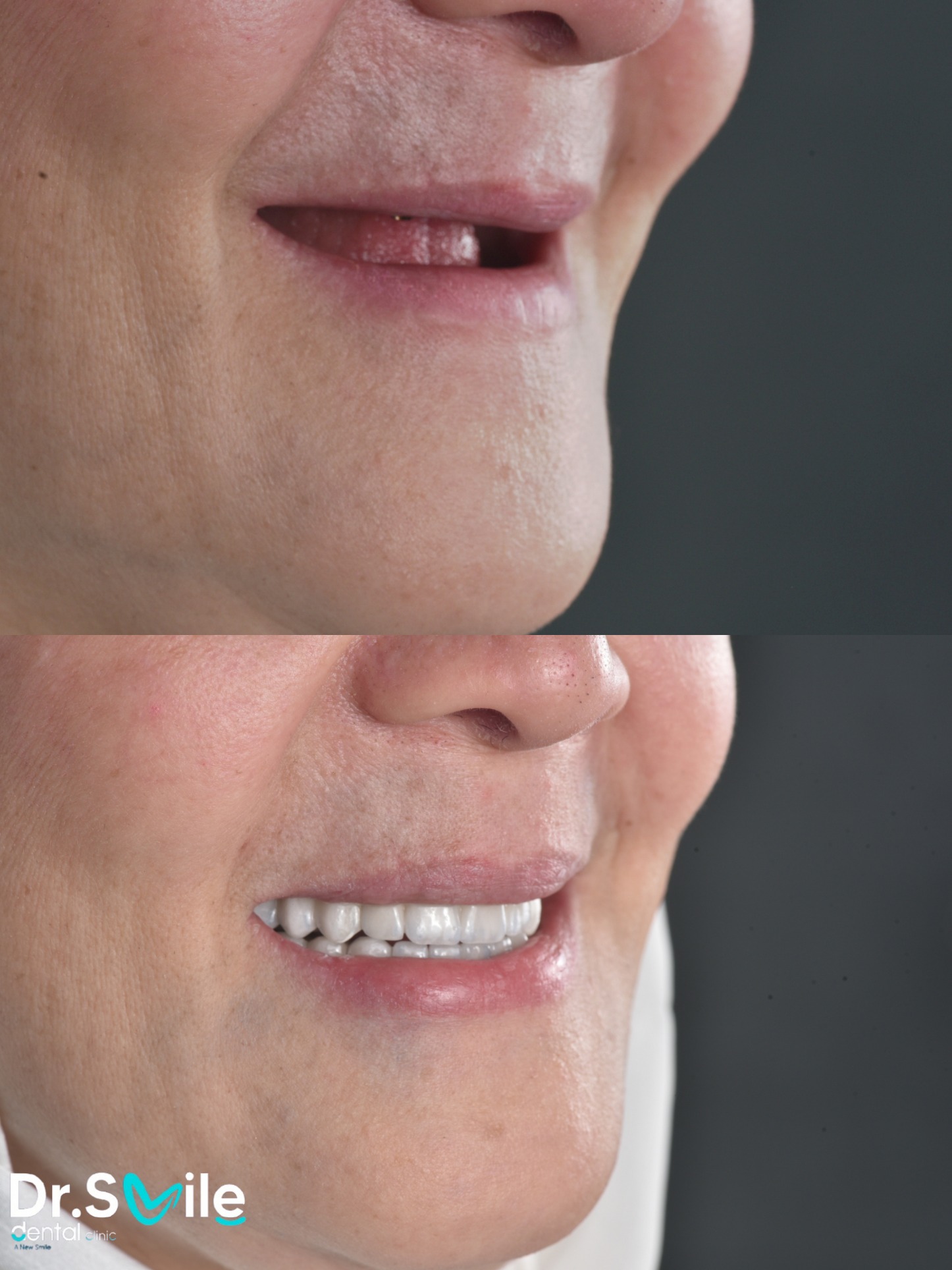 Dr.Smile Dental Clinic - لزراعة وتجميل الأسنان Facebook ad