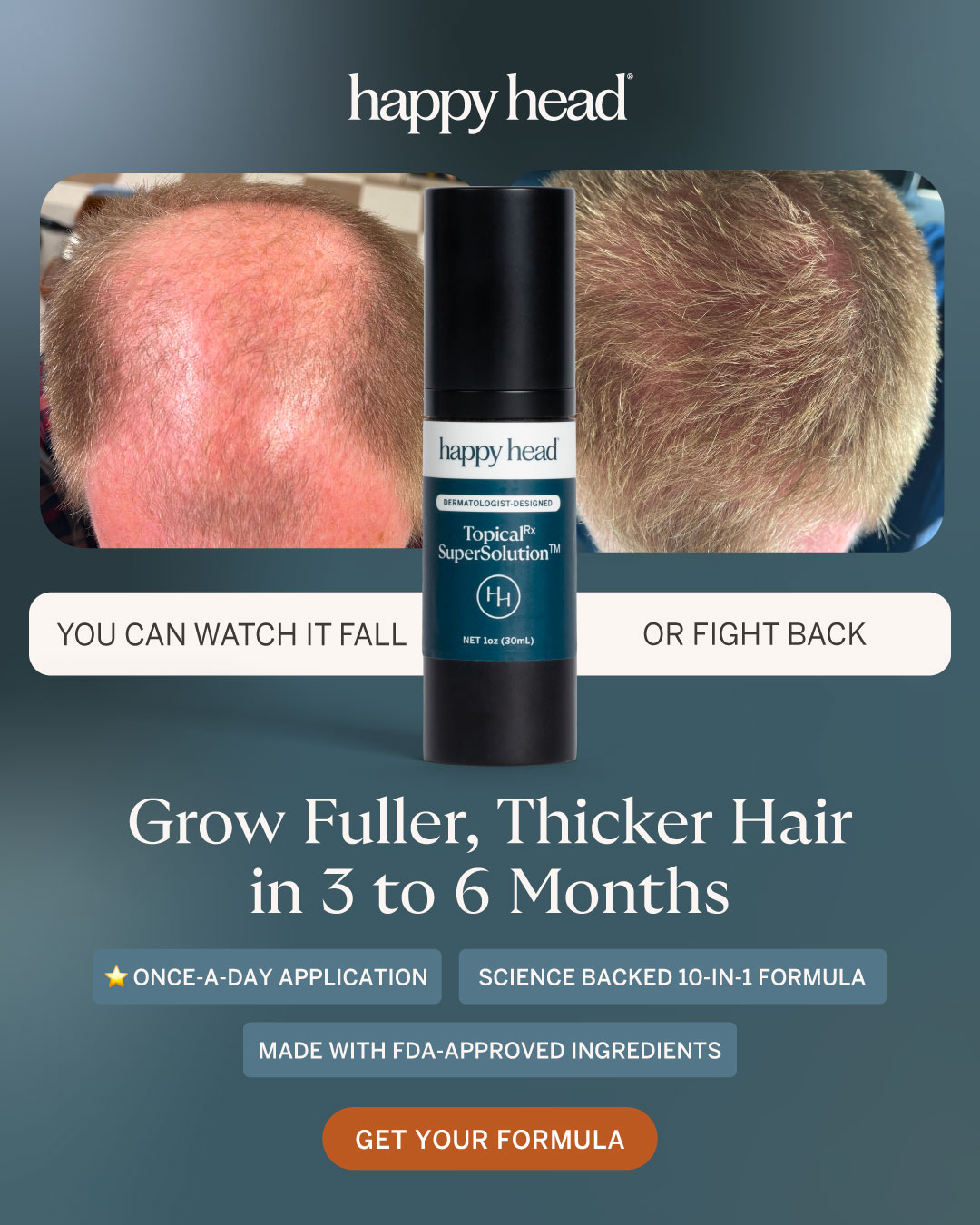 Happy Head Facebook ad