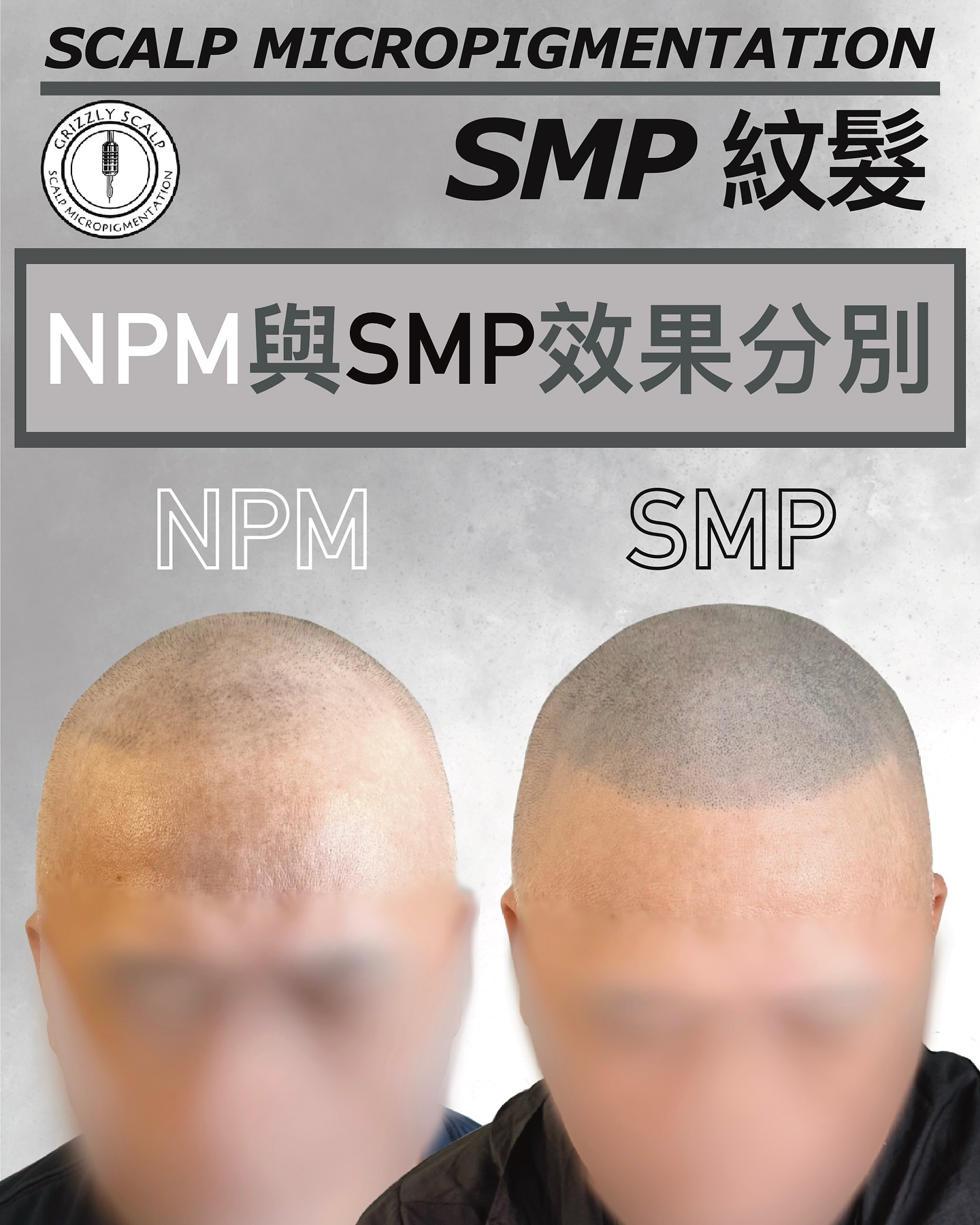 Grizzly Scalp 紋髮 Bob Ng Facebook ad