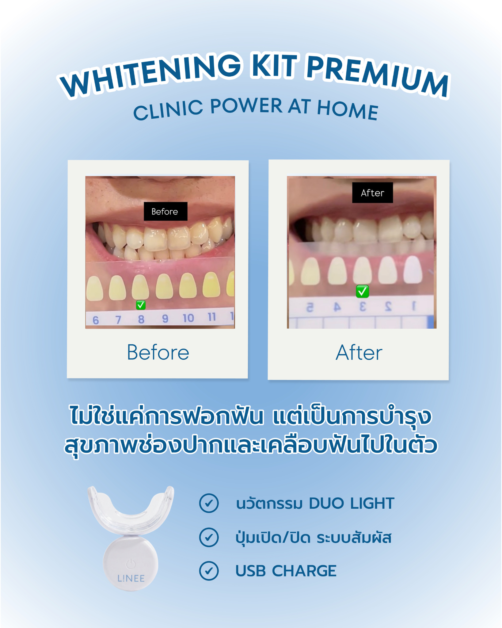 LINEE professional teeth whitening Facebook ad: ยิ้มสวยมั่นใจ. ในราคาสบายกระเป๋า!