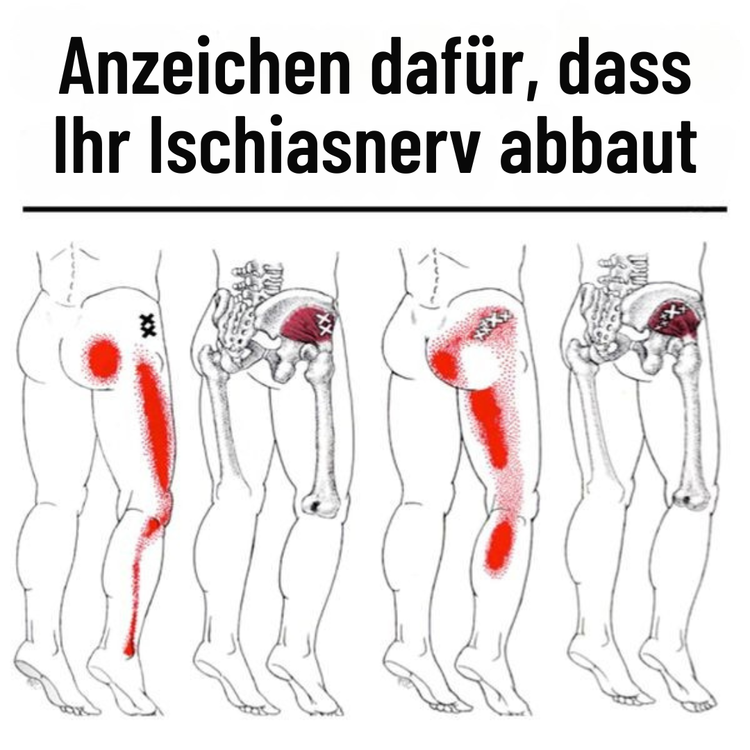 Natürlich und Gesund Facebook ad: Ischiasschmerzen? Probieren Sie das direkt nach dem…