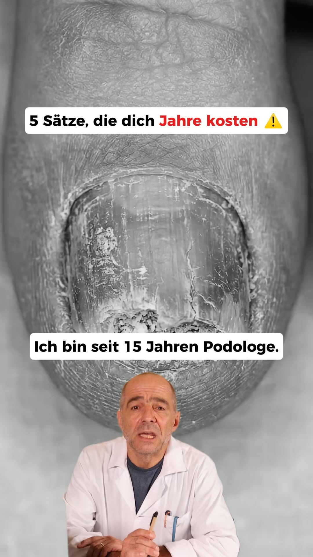 Nagelpilz Ratgeber Facebook ad: Der größte Fehler bei Nagelpilz