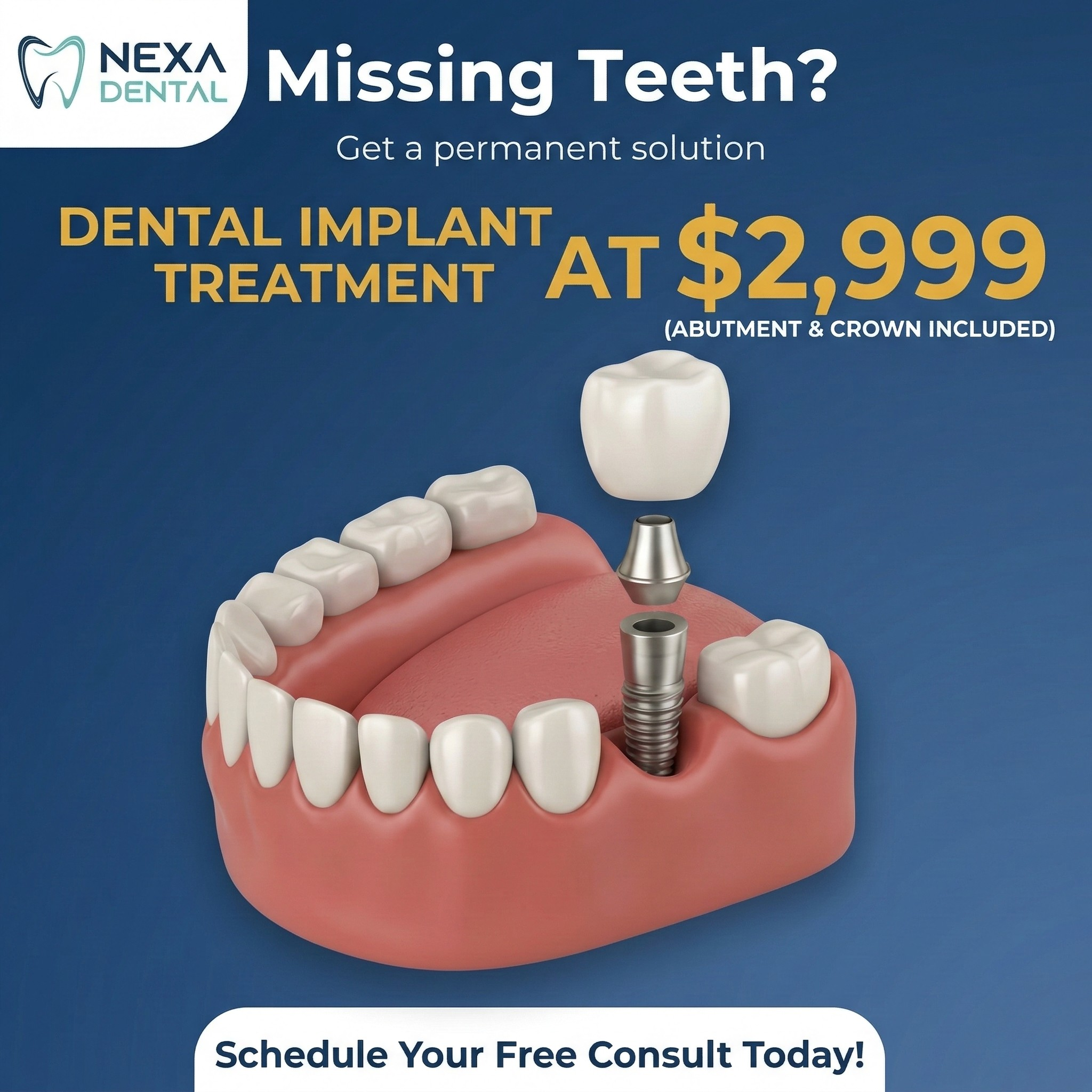 Nexa Dental Facebook ad: Hello Calgary! Dental Implant treatment at just $2999!