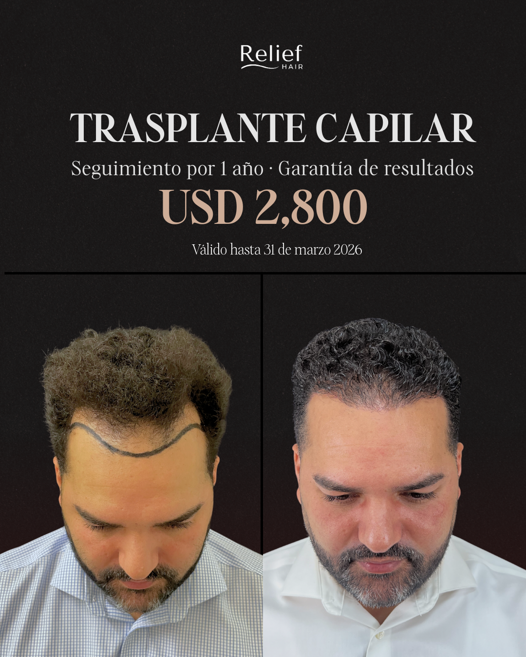 Relief Hair Facebook ad from Mar 5, 2026
