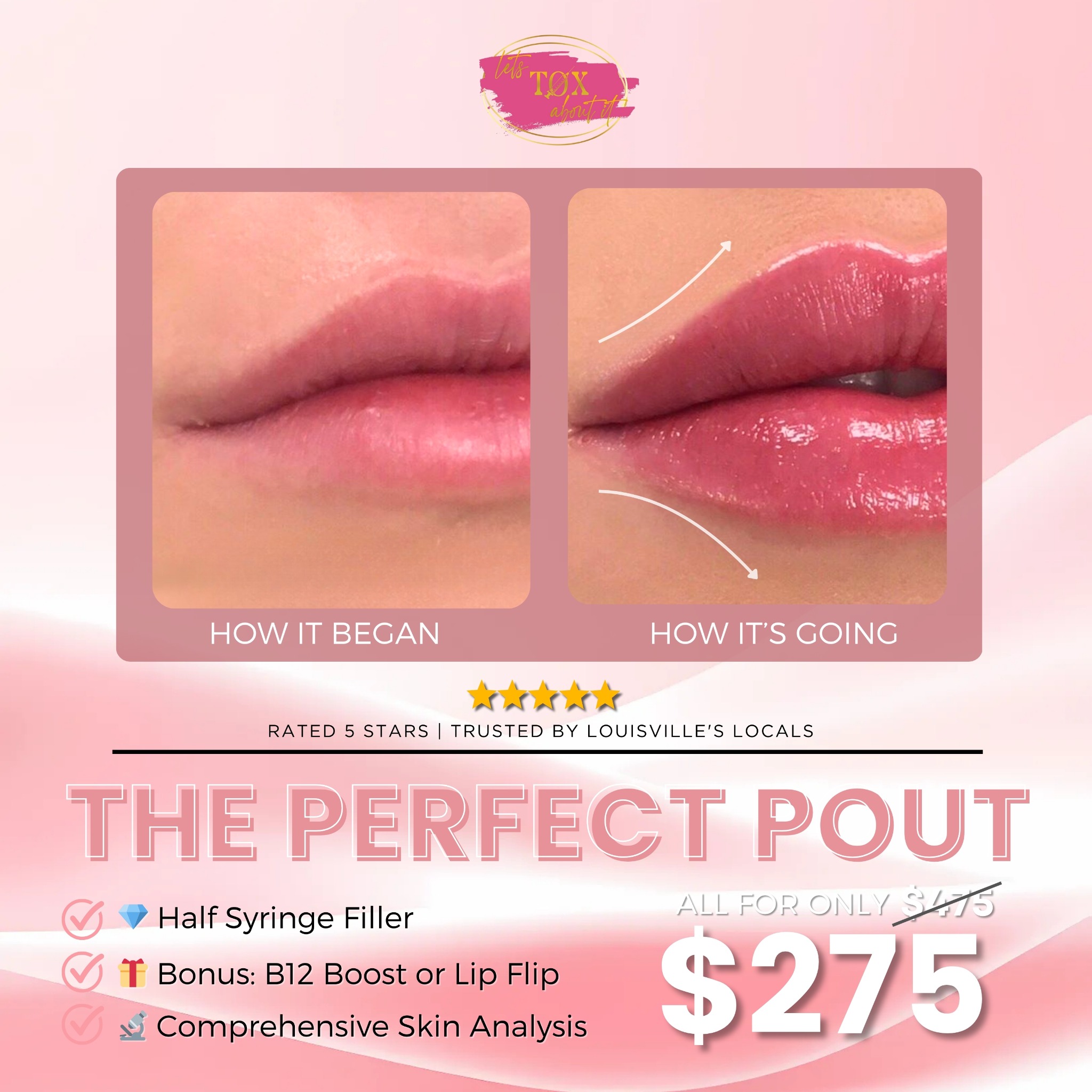Let's Tox About it Aesthetics Spa Facebook ad: The Perfect Pout Special