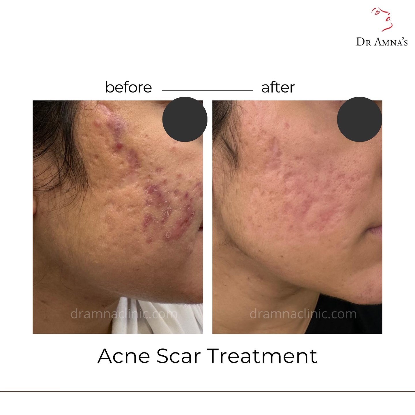 Dr. Amna's Skin Clinics Facebook ad: See the incredible before & after results of…