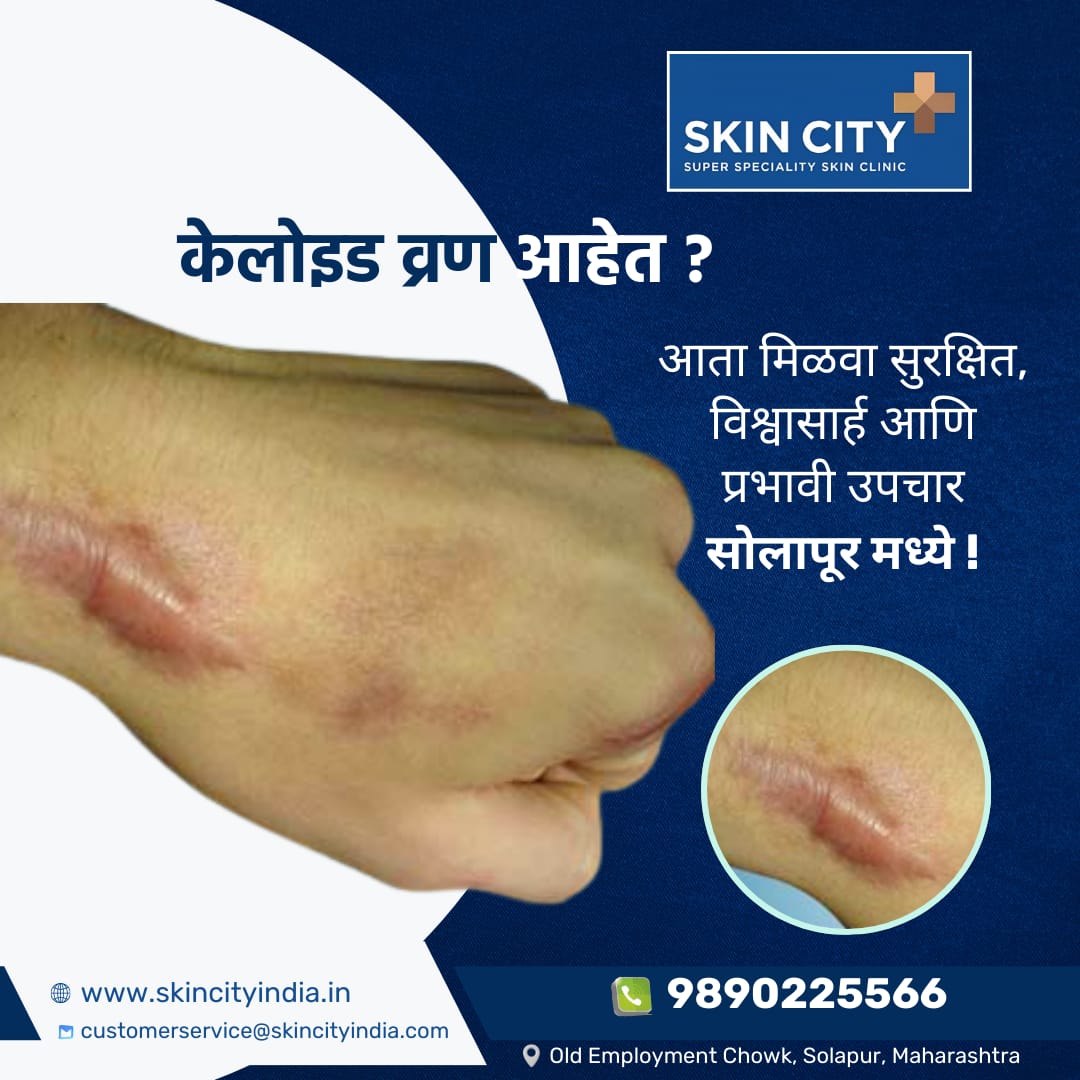 Dr. Dhepe's Skin City Facebook ad