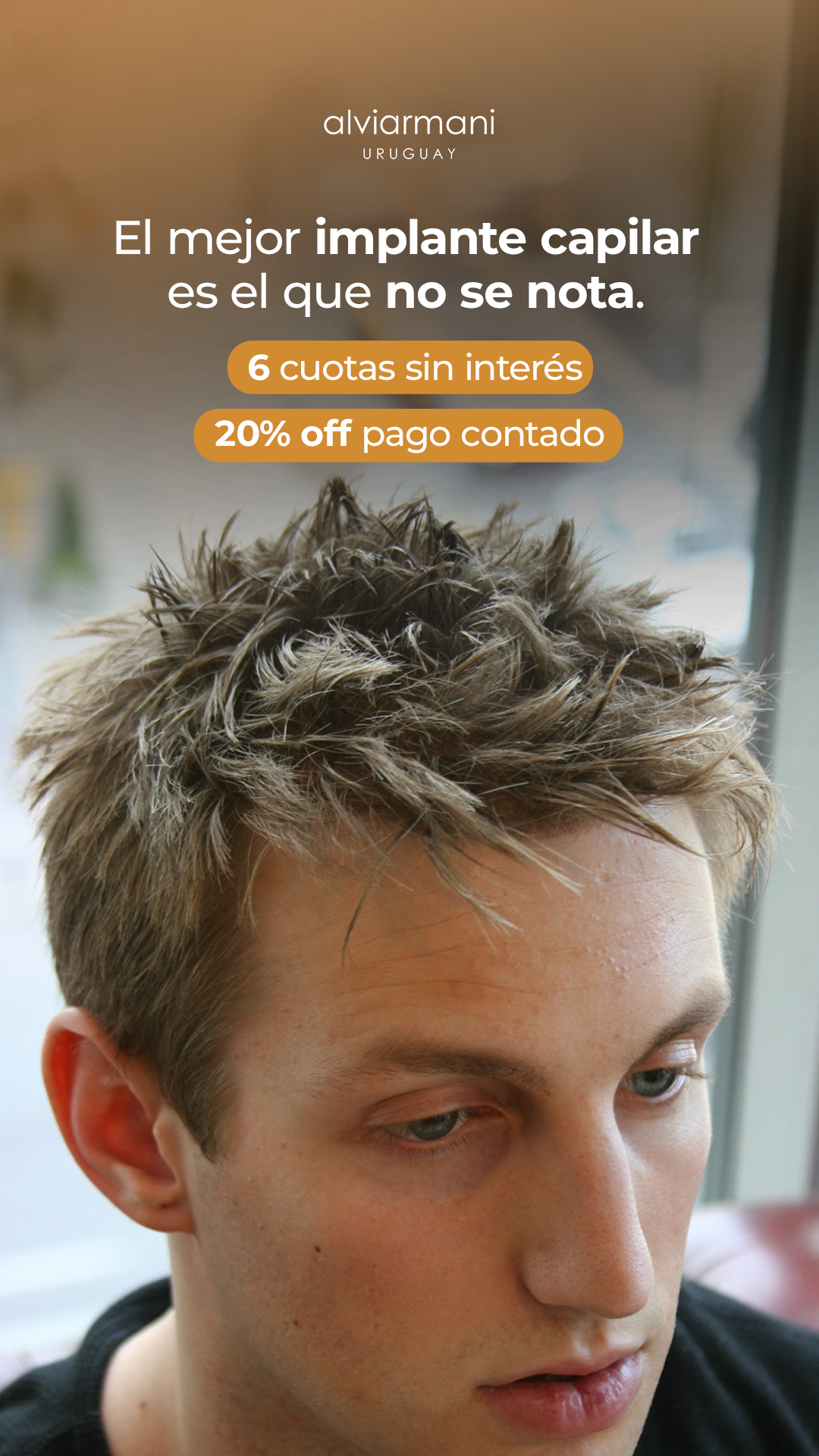 Alvi Armani Uruguay Facebook ad: Recuperá tu cabello
