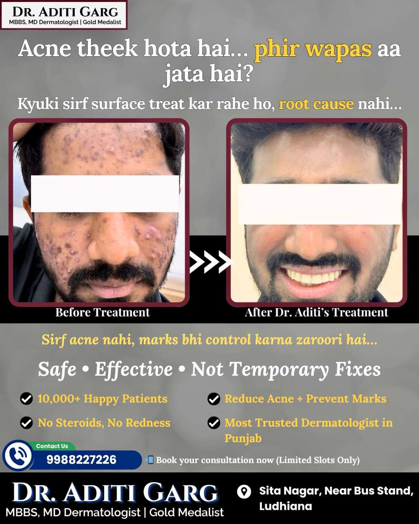 dr.aditiskinhair Facebook ad: Acne theek hota hai… phir wapas aa jata…