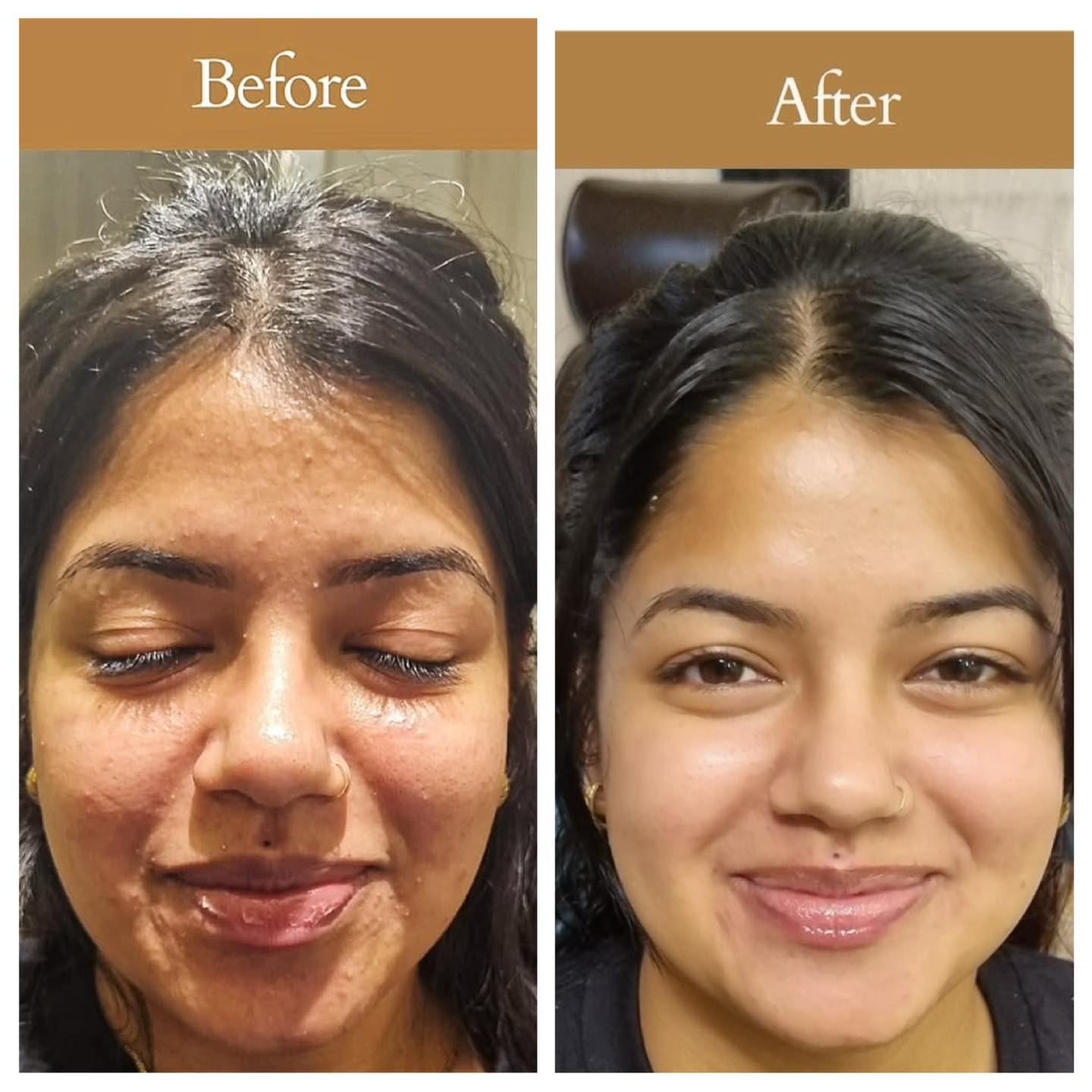 Glow Treatments Facebook ad: Glow Treatments Happy Customers