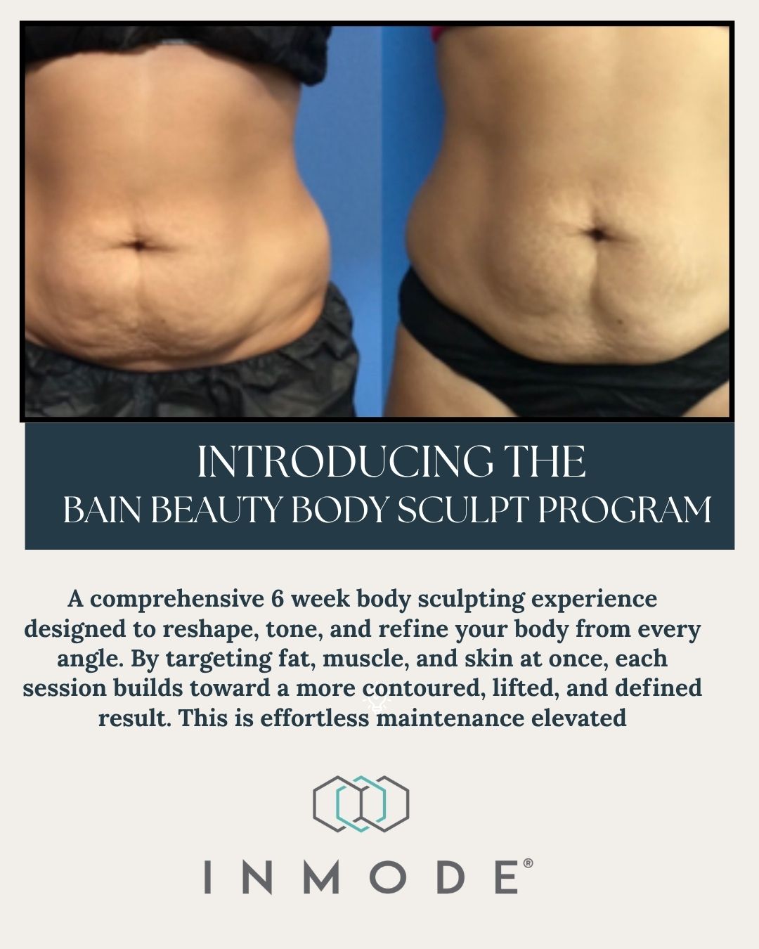 Bain Beauty Skin Spa Facebook ad: Experience the power of InMode Evolve-X an advanced…