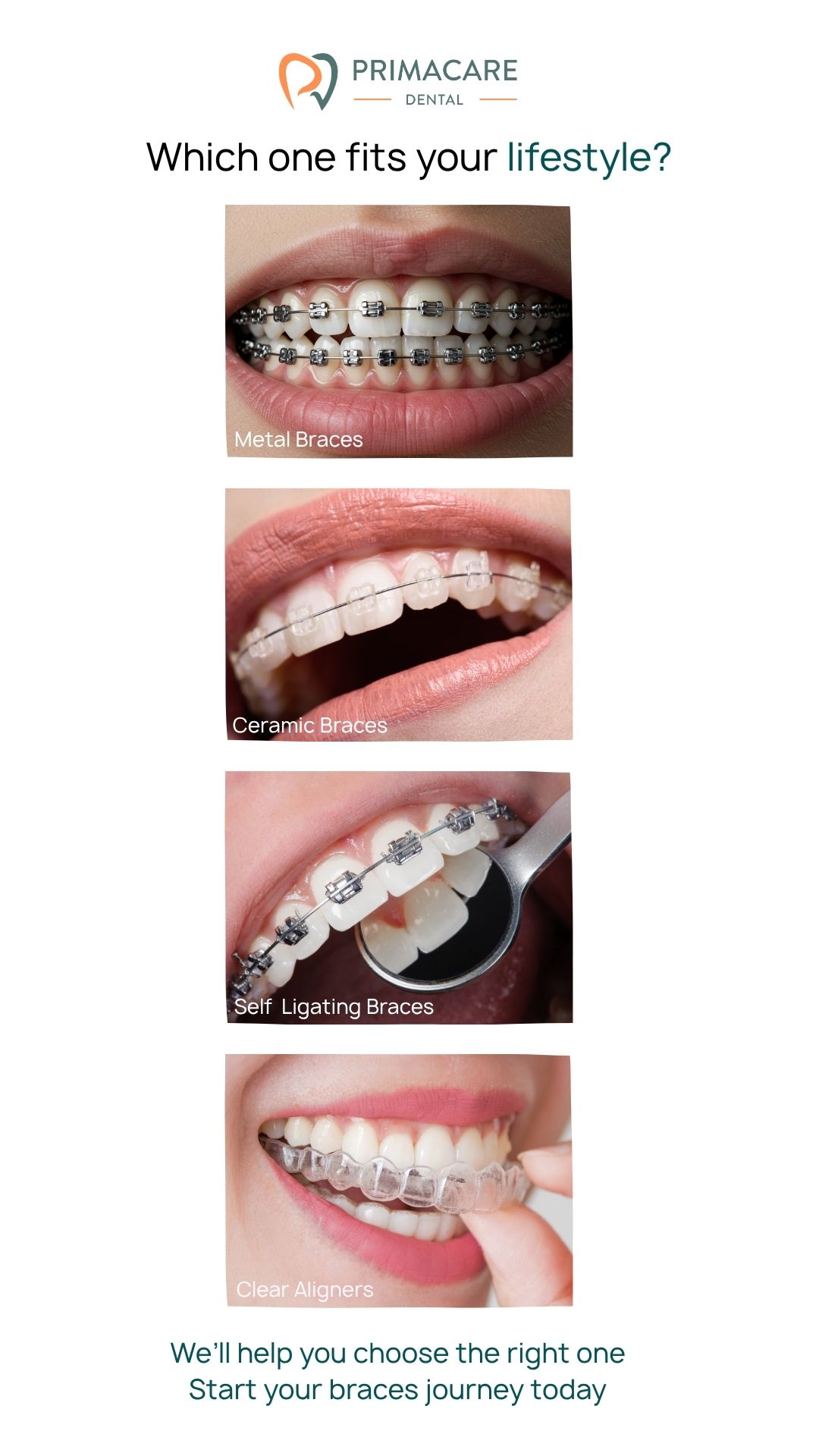 Primacare Dental San Jose Bulacan Facebook ad from Jun 11, 2025