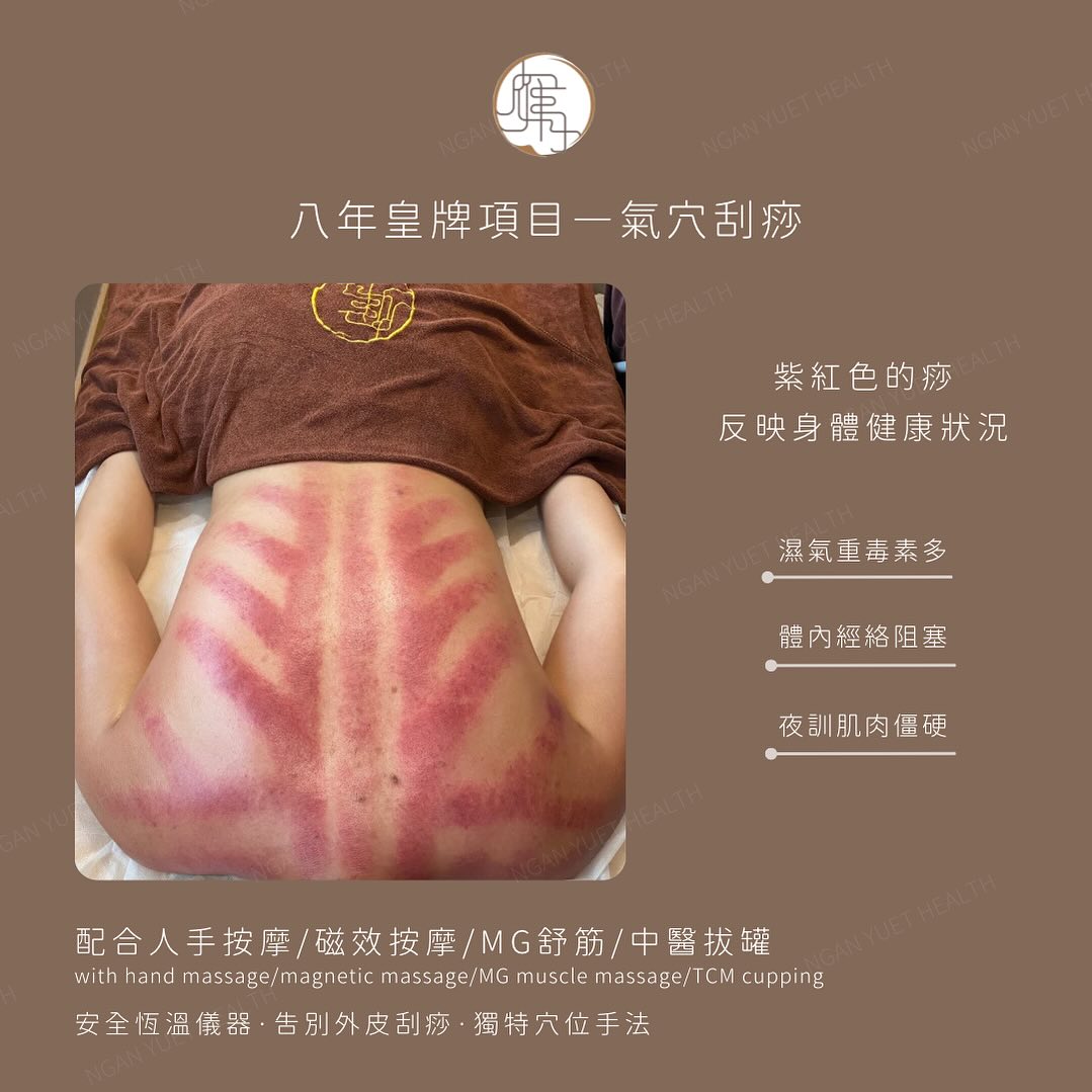 雁月中醫綜合中心 Facebook ad: 【中醫刮痧顏色反映身體狀況 】