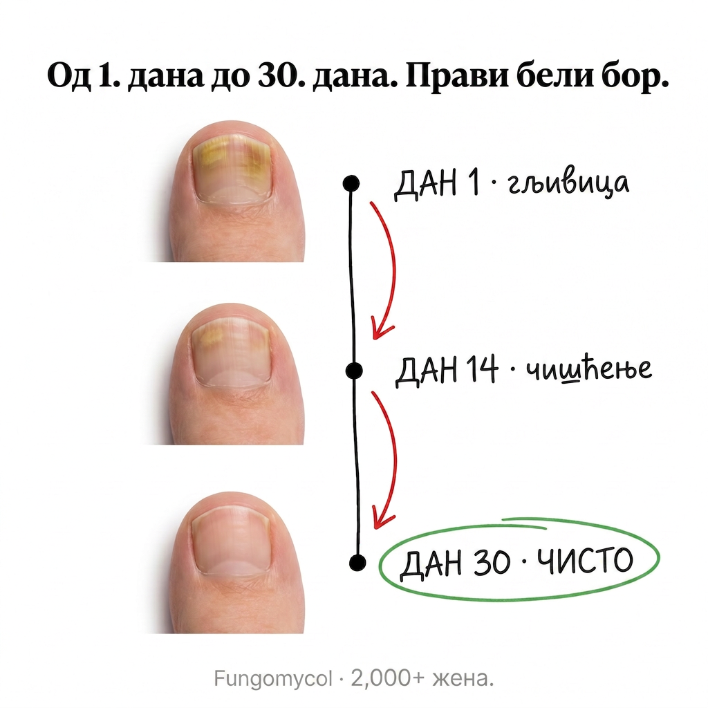 Organska Kozmetika - InaEssentials.rs Facebook ad: Dan 1 gljivica. Dan 30 zdravi nokti.