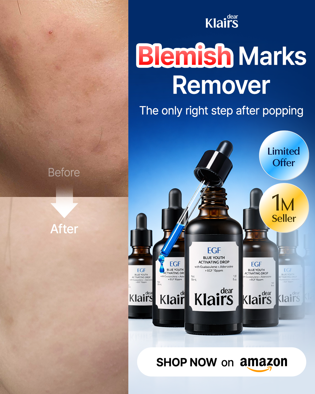 Klairs US Facebook ad from Jun 10, 2026