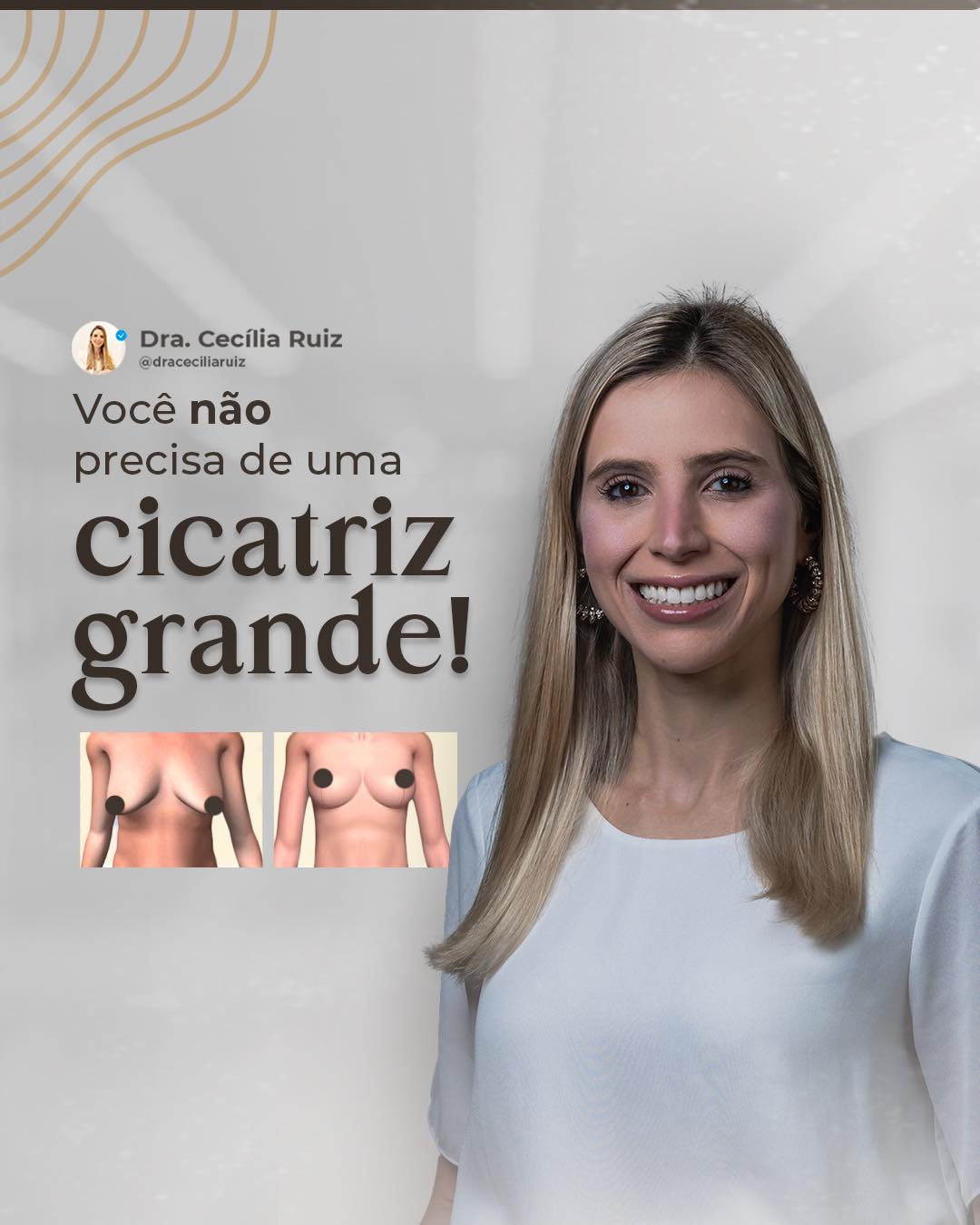 Drª. Cecília Ruiz - Cirurgiã Plástica Facebook ad