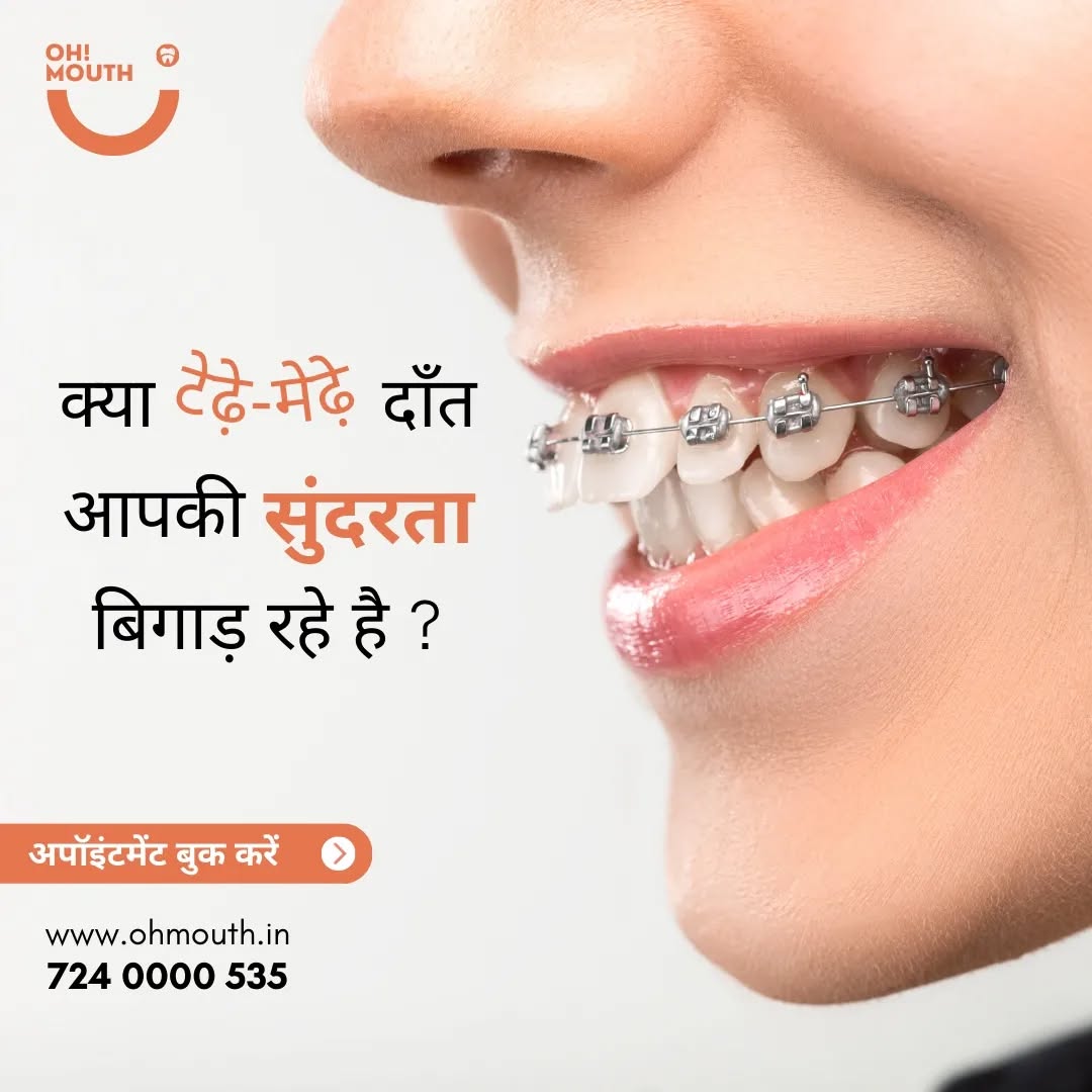 OH MOUTH Facebook ad: आज ही अपना अपॉइंटमेंट बुक करें