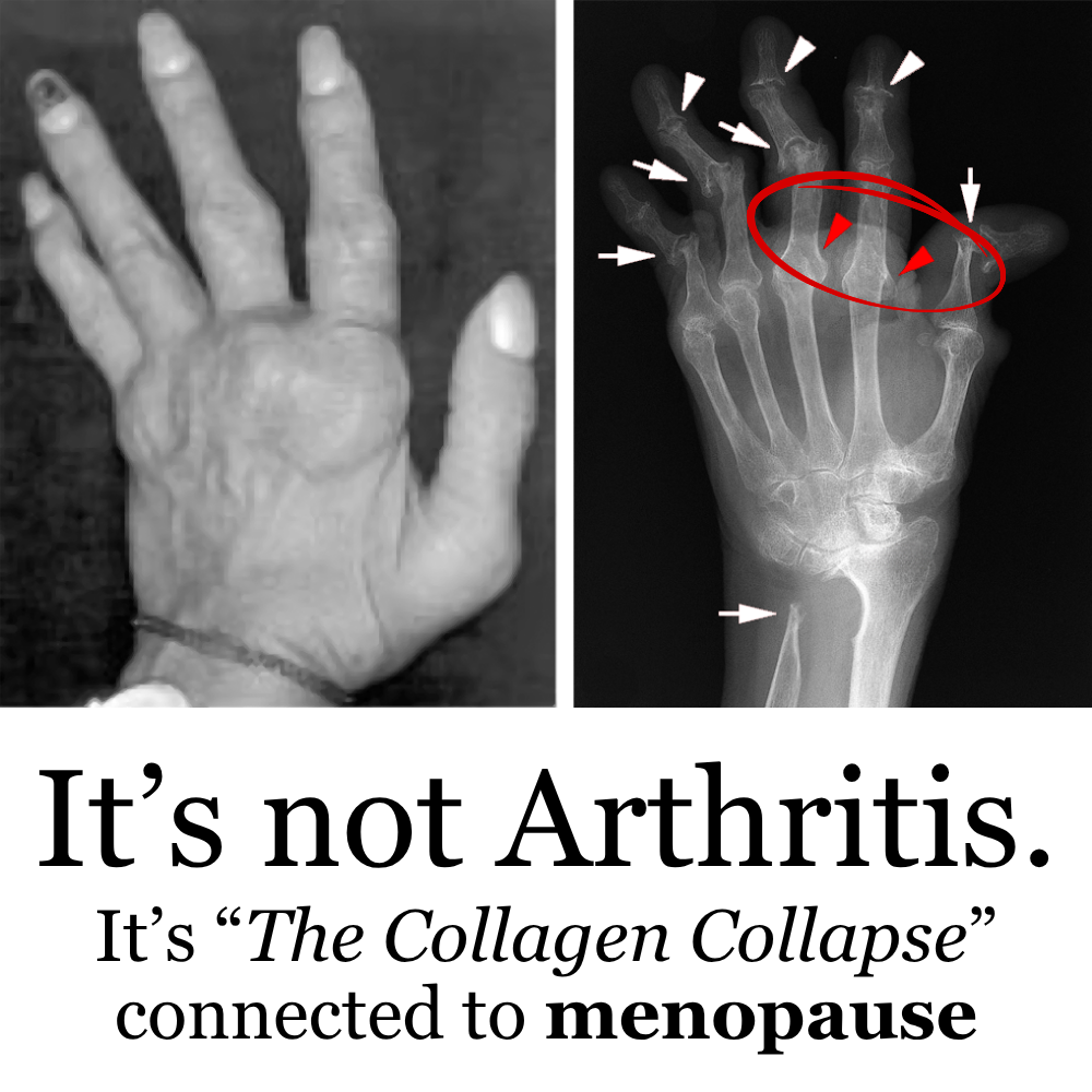 The Menopause Journal Facebook ad: Menopause did this to her hands