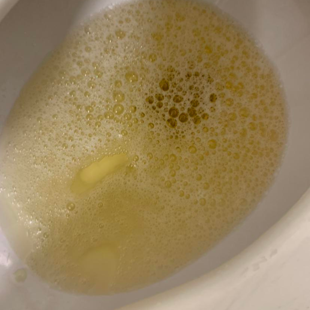 Nutritionist - Carolyn Hurst Facebook ad: Find out what's actually making your filters leak