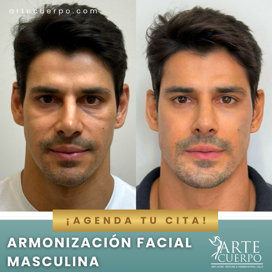 Clinica spa arte cuerpo  Facebook ad