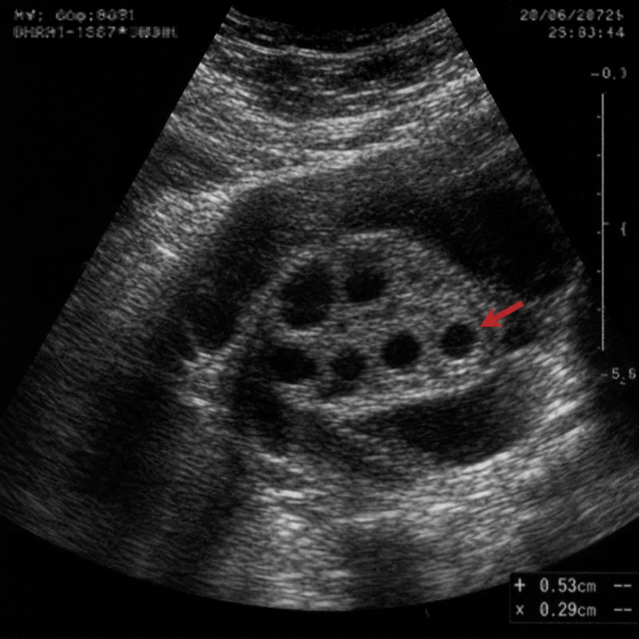 Dr. Sarah Mitchell, MD Facebook ad from May 12, 2026