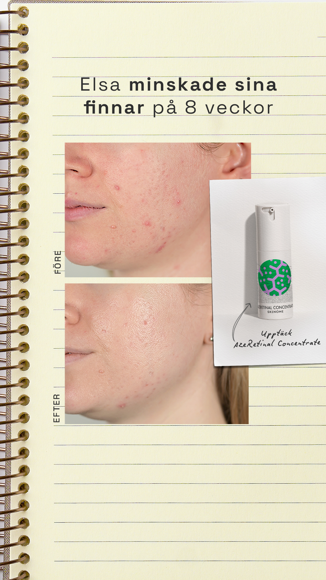 Skinome Facebook ad