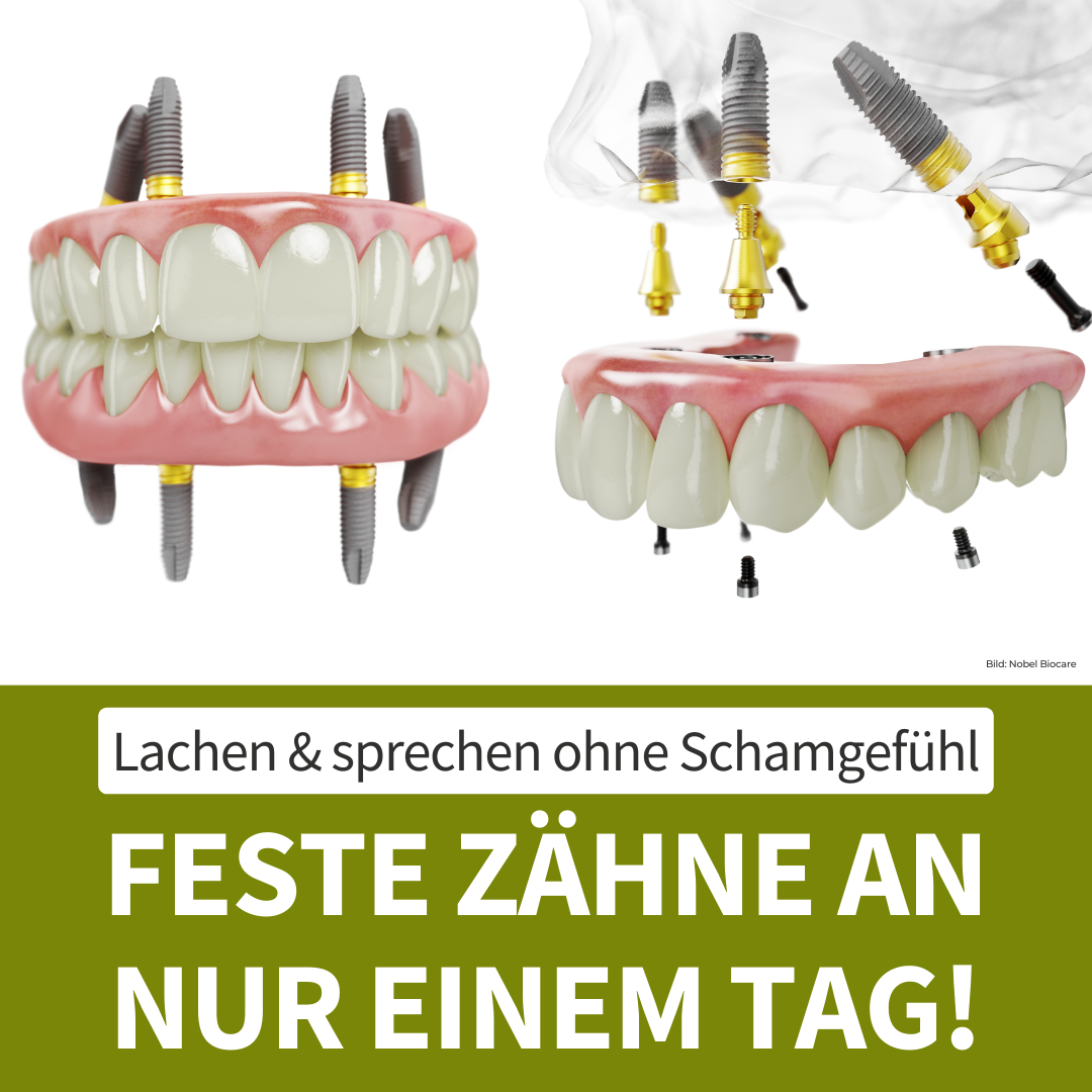 ImplantatZentrum Bern AG Facebook ad from Oct 10, 2024