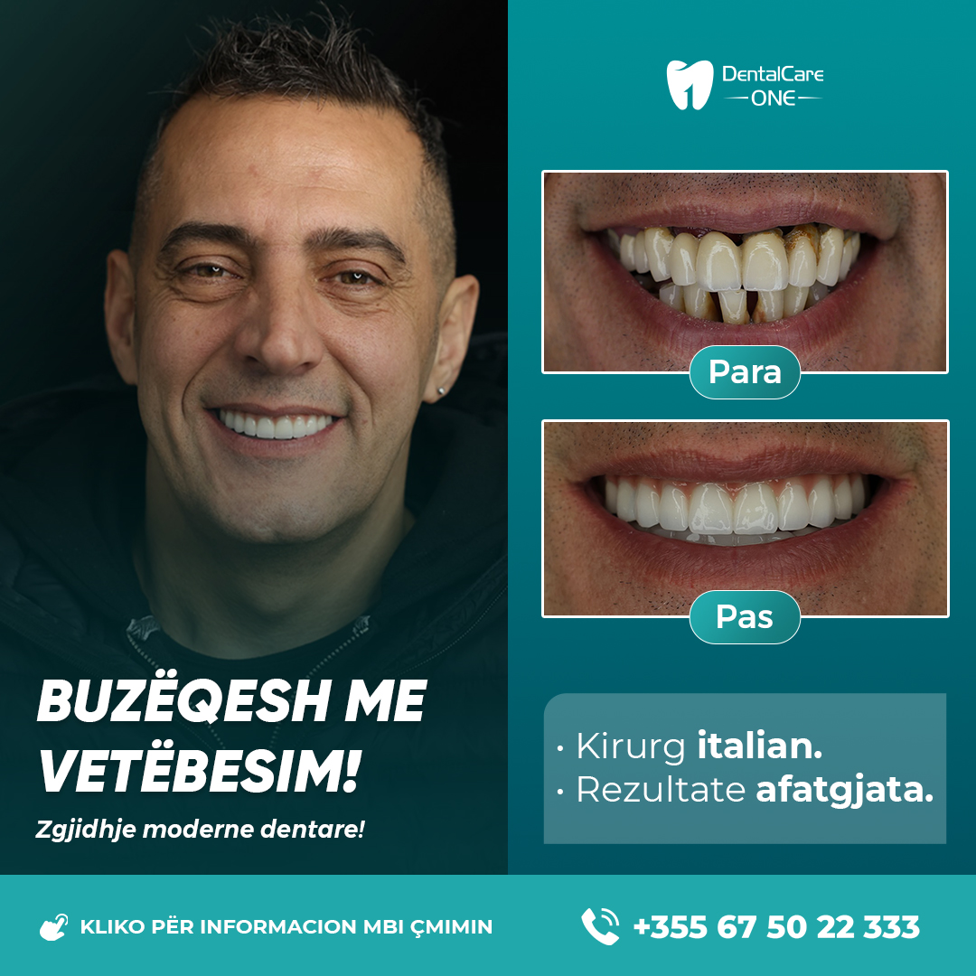 DentalCare One Albania Facebook ad