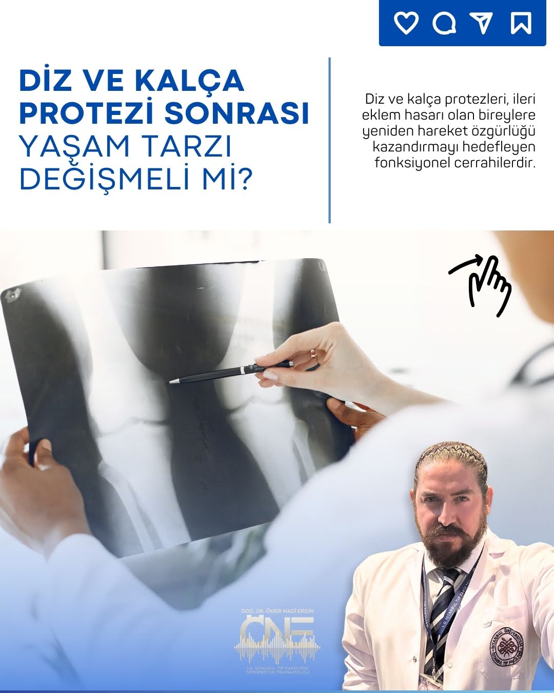 Doç. Dr. Ömer Naci Ergin Facebook ad: Diz ve kalça protezleri, ileri eklem hasarı olan…