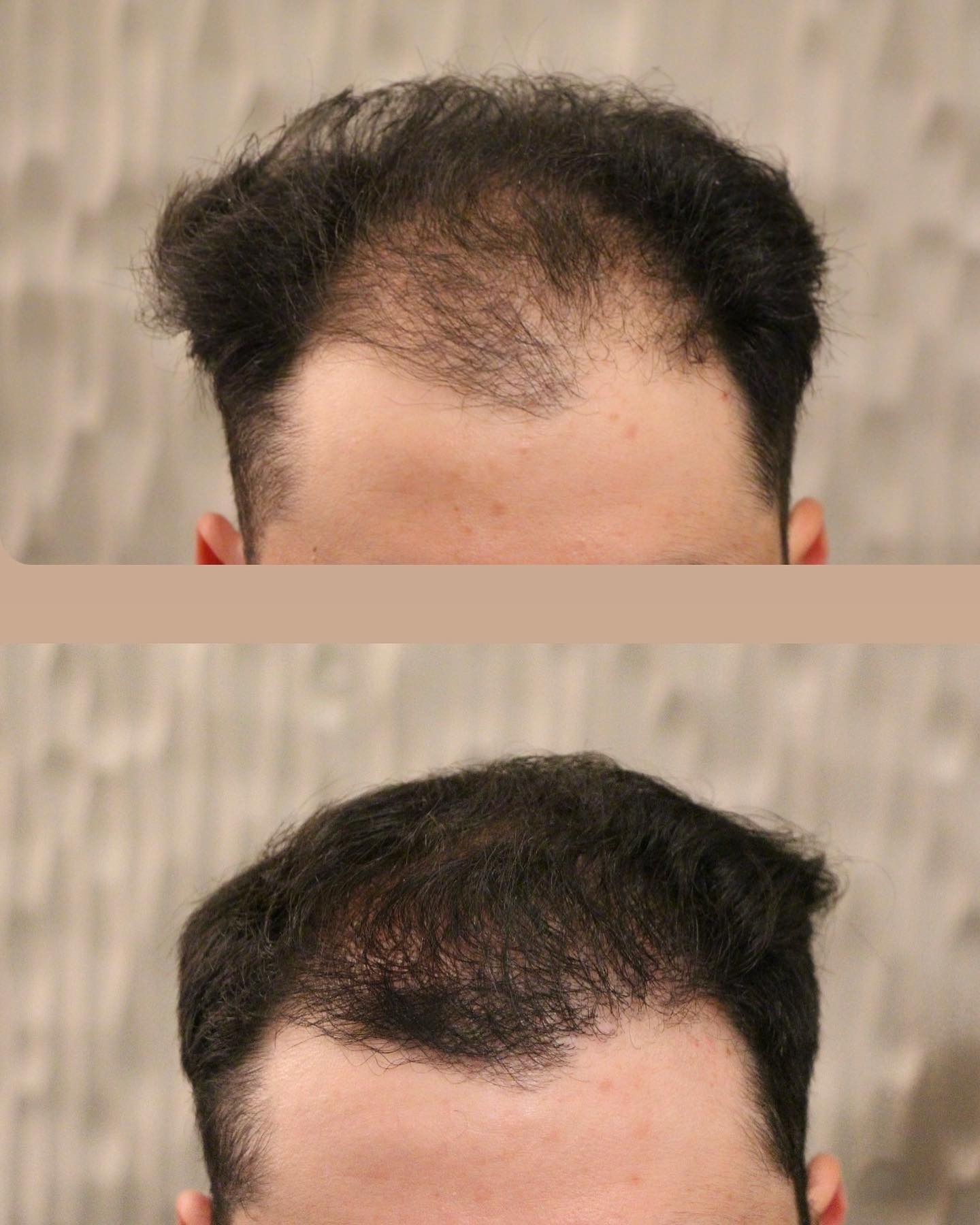 Modena Hair Institute Facebook ad