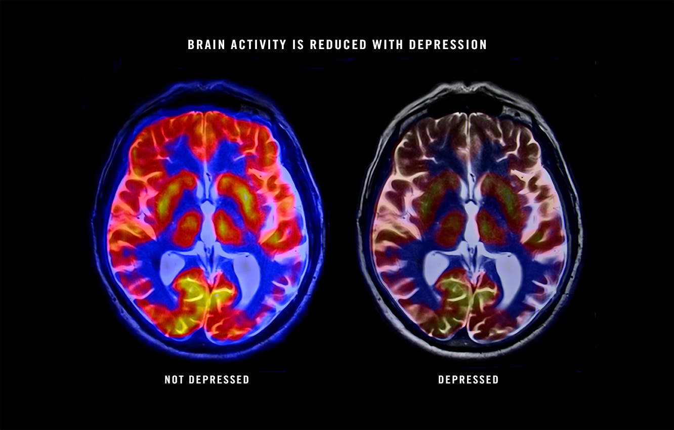 Communikare Behavioral Health Services LLC. Facebook ad: Depression & Anxiety Relief Consultation