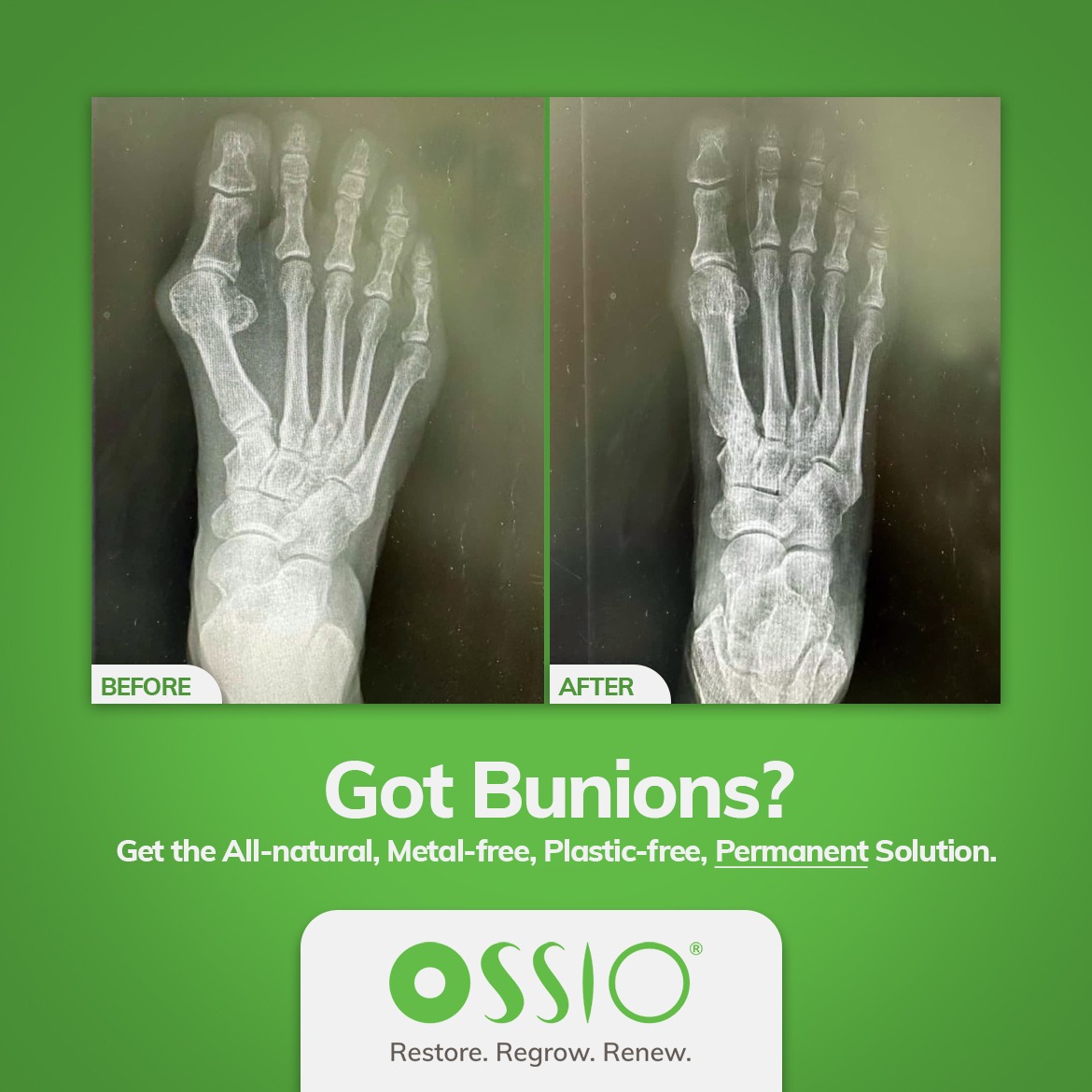 OSSIO Facebook ad from Mar 5, 2025