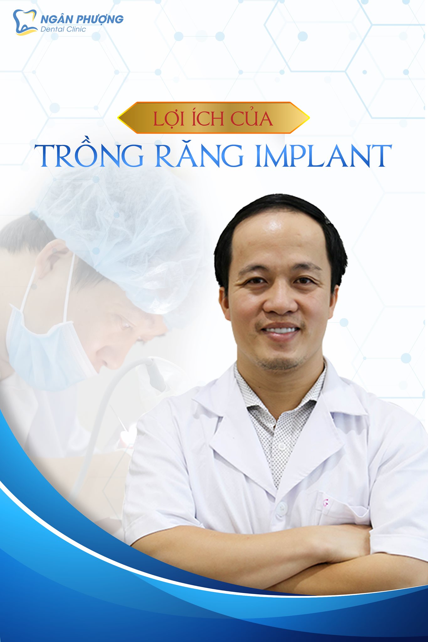 Nha Khoa Ngân Phượng Facebook ad: 6 LỢI ÍCH KHI TRỒNG RĂNG IMPLANT