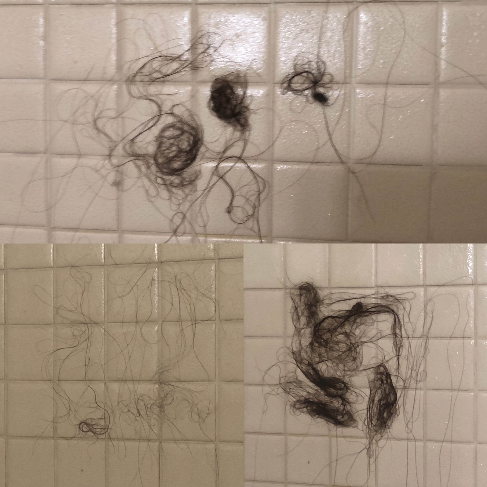 The Honest Root Facebook ad: What am I doing wrong with my postpartum hair loss?