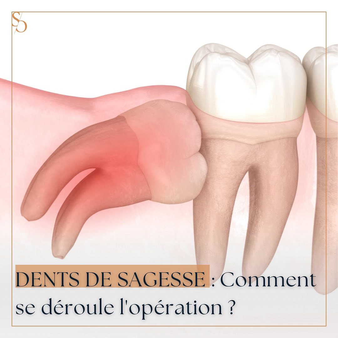 Etablissement Dentaire Sana Oris Facebook ad